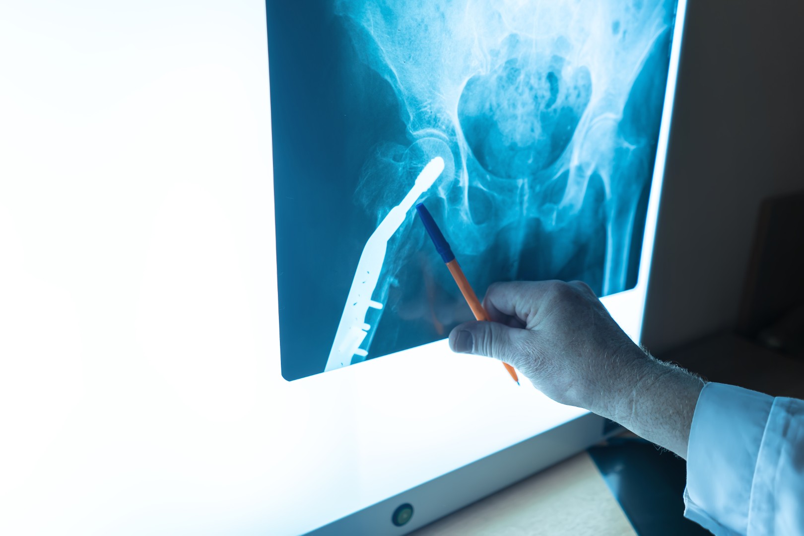 Radiologia Tradizionale - Medico esamina radiografia