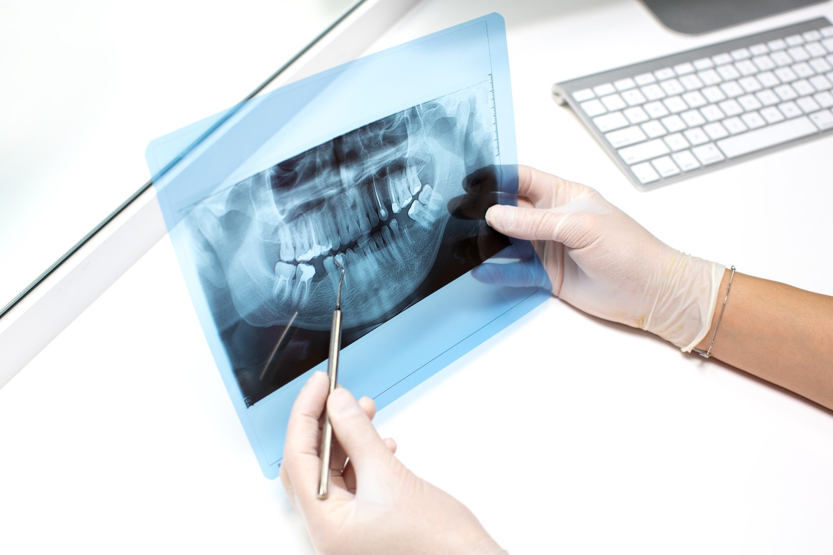 Dentista esamina radiografia dei denti